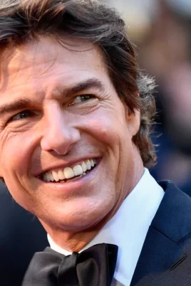 Celebrities with Teeth Implants before and after