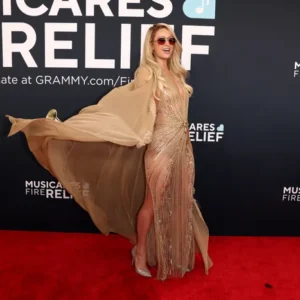 celebrities with knock knees​
